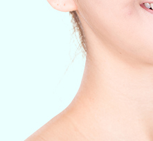 为什么会出现颈纹